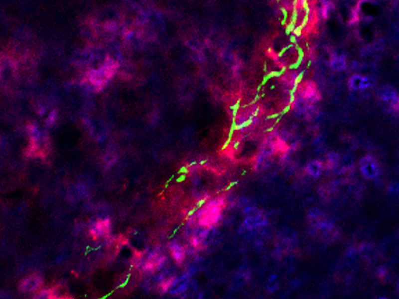 2024 Barriers of the CNS Conference GRC